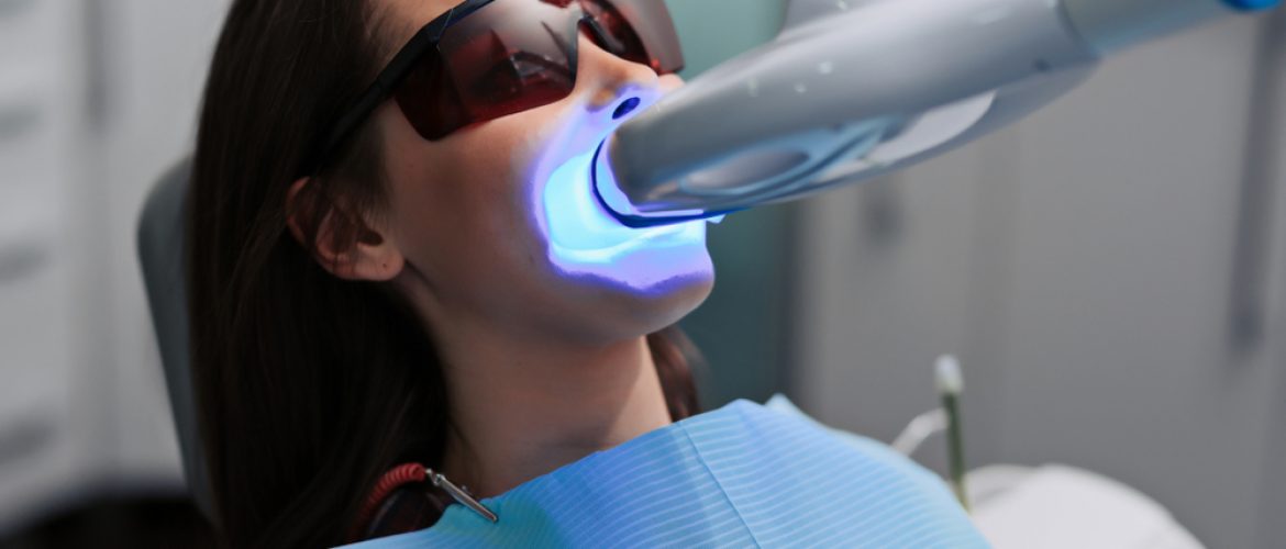 Quy trình tẩy trắng răng gồm những bước nào?