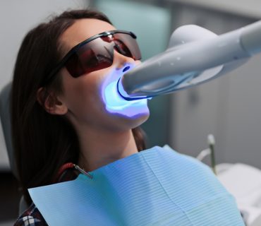 Quy trình tẩy trắng răng gồm những bước nào?