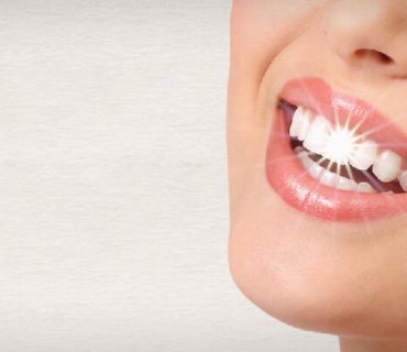 Tẩy trắng răng là gì? Các phương pháp tẩy trắng răng hiệu quả