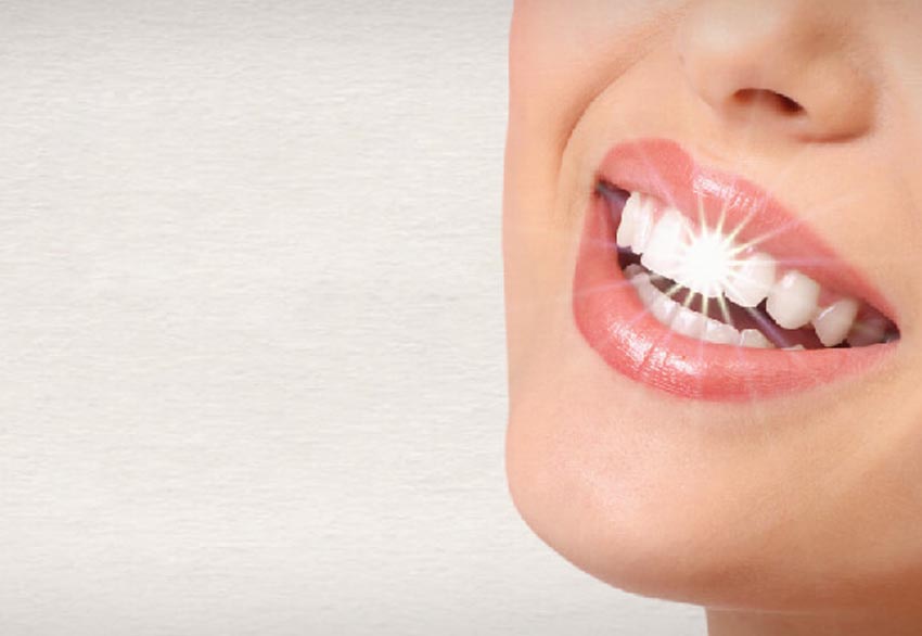 Tẩy trắng răng là gì? Các phương pháp tẩy trắng răng hiệu quả
