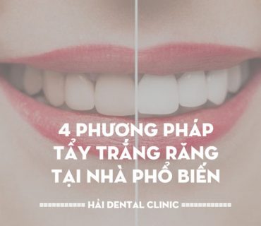 4 phương pháp tẩy trắng răng tại nhà phổ biến