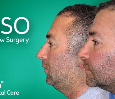 Kỹ thuật phẫu thuật hàm BSSO là gì? Quy trình thực hiện ra sao?